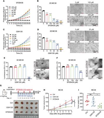 EZH2 Inhibitors Suppress Colorectal Cancer by Regulating Macrophage Polarization in the Tumor Microenvironment